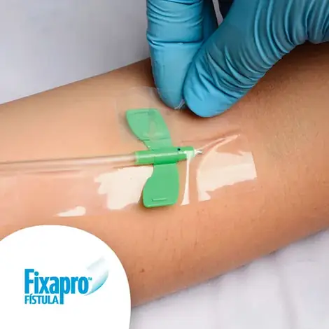 Fixapro Fistula