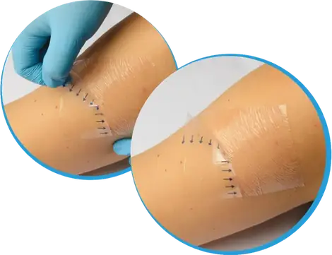 Fixapro Roll